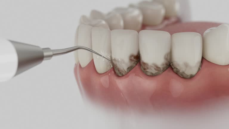 Reliable Dental contractor in Glendale, MO by Smile Center Dentistry